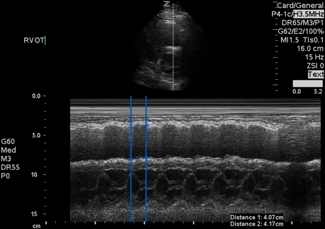 Screen Shot 2017-12-20 at 9.34.22 AM